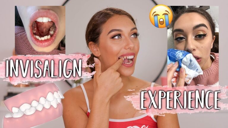 Esempi di Recensioni Positive per un Dentista