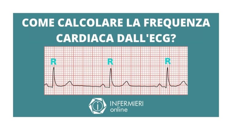 Calcolare la Frequenza Cardiaca con l’ECG: Guida Pratica